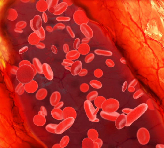 cholesterol-plaque-blood-vessel_151689-42