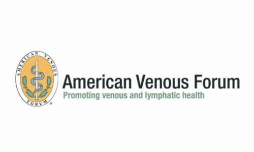 varicose veins surgery cost near wilmington, nc